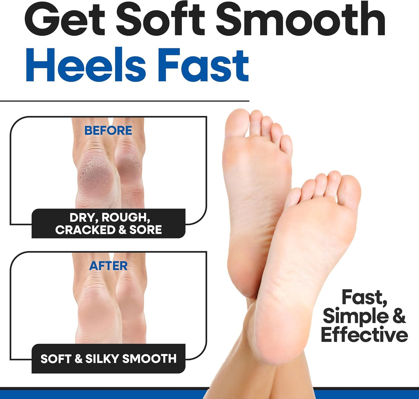 Moisturizing Socks for Women & Men | Aloe Vera Cracked Heel Treatment | Foot Callus Remover | Aloe Socks for Cracked Heels & Dry Cracked Feet (3 Pairs, X-Large)