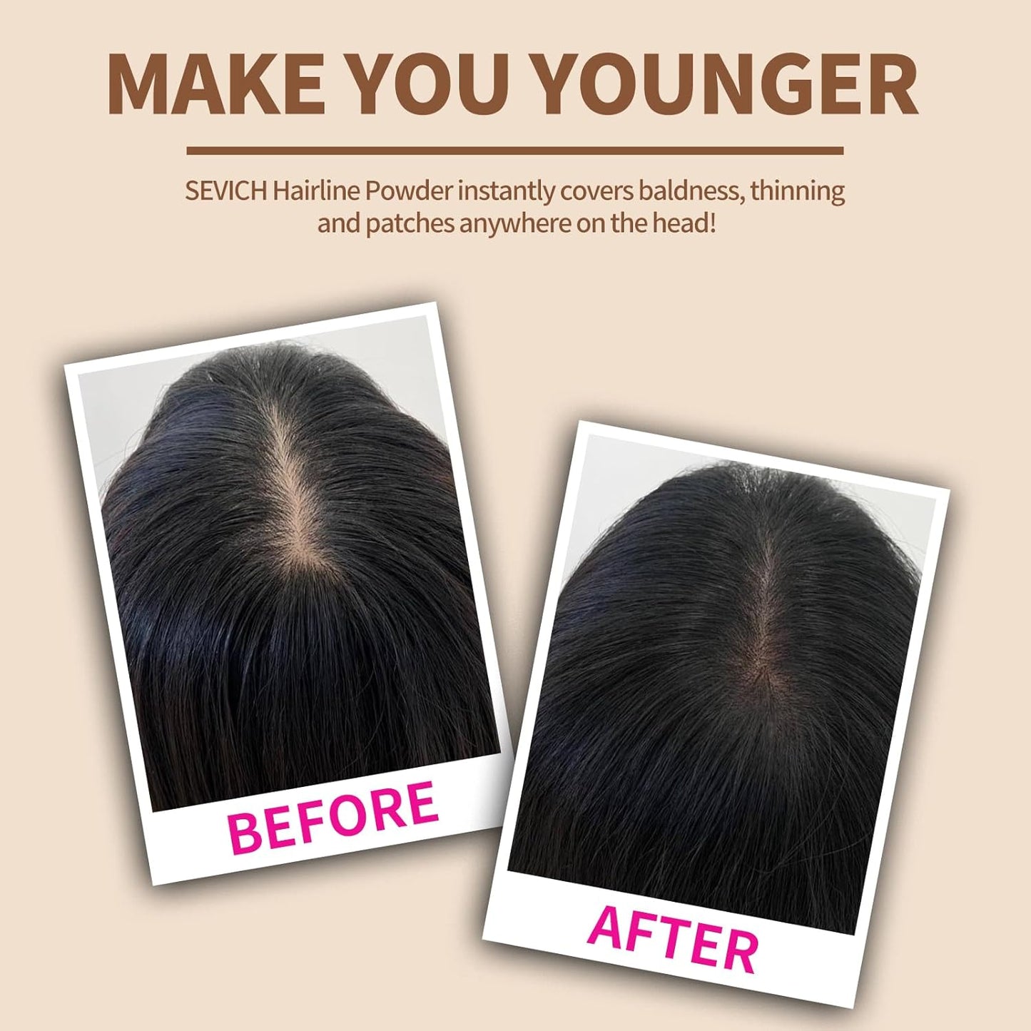 Sevich Hairline Powder，Instantly Conceals Hair Loss, Root Touch up Powder, Hair Shadow Toppers for Women & Men, Touch Up for Thinning Gray Hair, Windproof & Sweatproof, Medium Brown