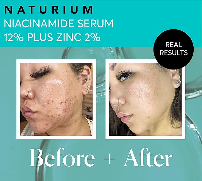 Naturium Niacinamide Face Serum 12% Plus Zinc 2%, Anti-Aging, Pore Minimizer & Dark Spot Corrector with Hyaluronic Acid & Vitamin E, Vegan & Cruelty-Free, 1 oz