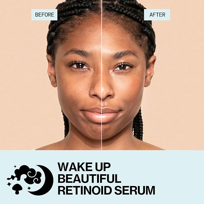 Pacifica Retinol Serum for Face - Wake Up Beautiful Retinoid Night Face Serum - Anti-Aging Skin Care & Skin Brightening - Retinol, Collagen & Antioxidants Vegan & Cruelty-Free Dermatologist Tested
